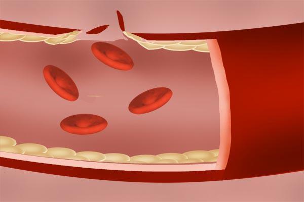 降压|高血压能不能喝酒为何有人说喝酒能降压告诉你答案,别搞错了