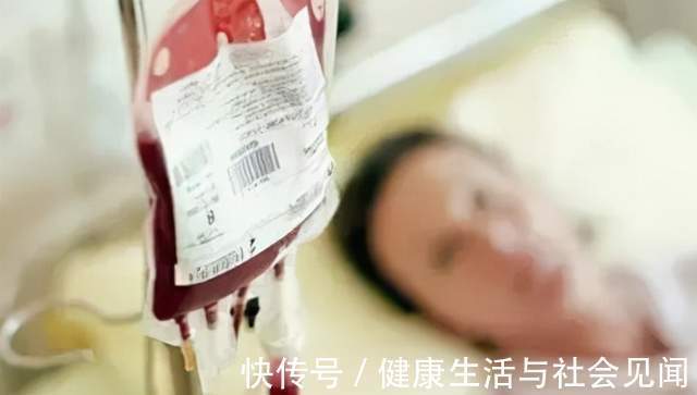 乏力|频繁头晕、乏力可能是贫血!谢别录:贫血有很多种,看你是哪一种