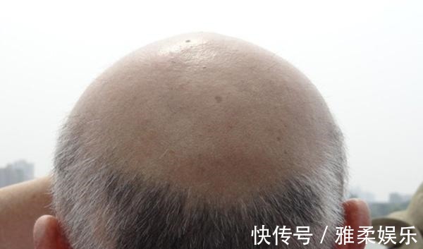 气血|脾衰,人就废一半,找到脾的“恩人”,坚持吃,养好脾脏