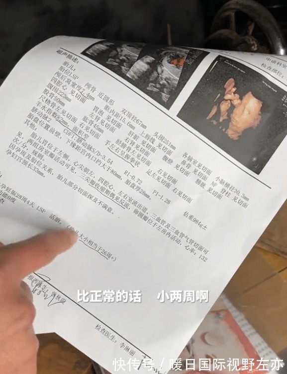 牛爱芳晒妻子孕检单,却隐藏关键信息,吃鱼只吃鱼尾,真豪气!