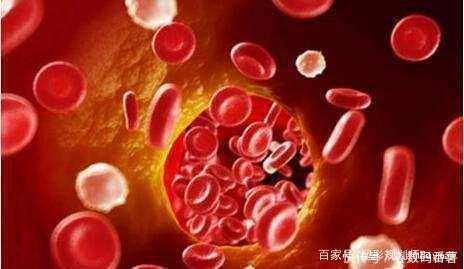 偷偷|甘油三酯高,1种常见籽煮来喝,甘油三酯偷偷降了