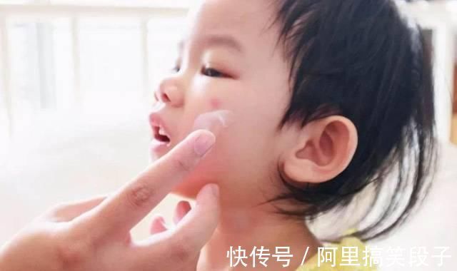 蚊虫|宝宝被蚊虫叮咬后,90%妈妈都做错!擦这个止痒最有效!