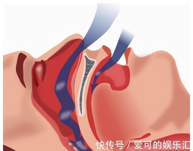睡眠质量|准妈妈们注意了!怀孕到了后期,睡眠质量最不佳的5大干扰