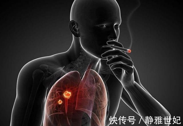 吸烟|医生劝别人“戒烟”,为什么自己抽个不停?今天给你揭秘“真相”