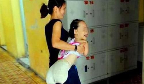 产检发现宝宝“缺少四肢”,宝妈却坚持要生,如今孩子活成小公主