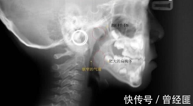 老公|孩子越长越像猴子,老公怀疑老婆整容了,检查结果全家人都吓坏了