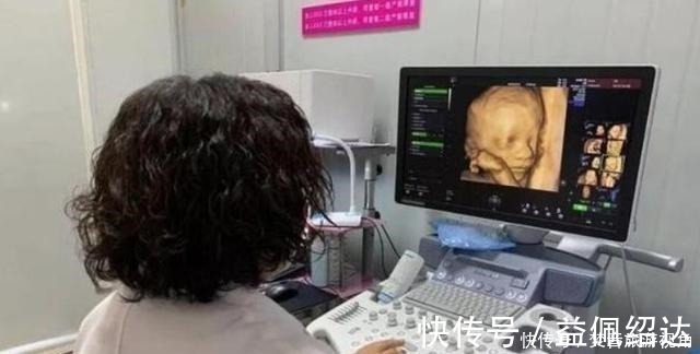 医生|“天才”胎儿走红,还在妈妈肚里就会“算数”,医生清华北大等你