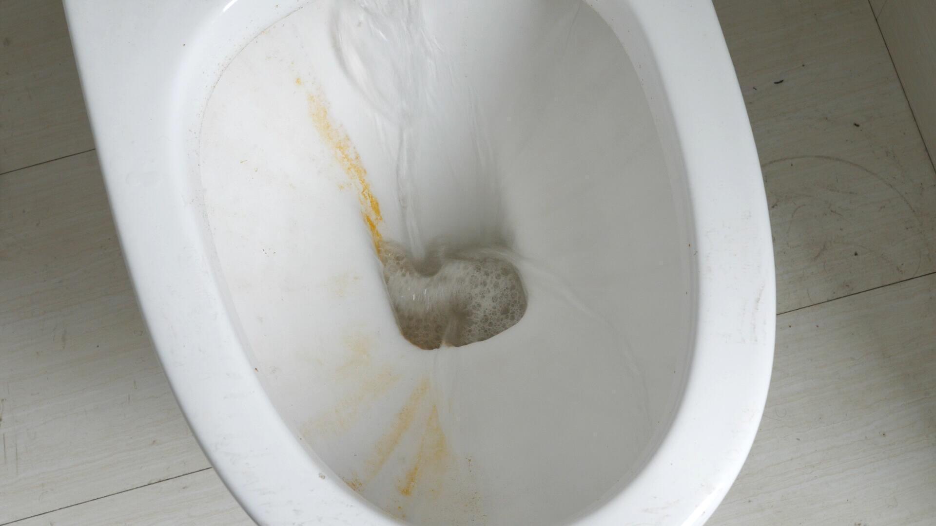 马桶黄渍又脏又臭，教您一个小窍门，不仅擦得干净，还不会有臭味