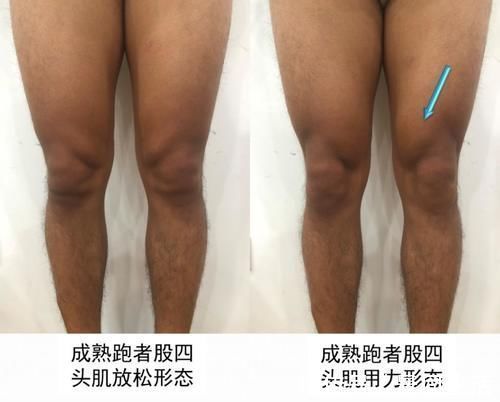 股四头肌|坚持跑步给你留下训练痕迹了吗?跑者的十大形态特征