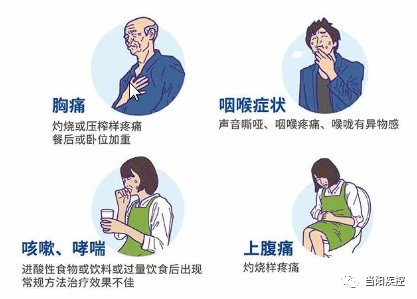 反流|长期“反酸”，你值得注意！