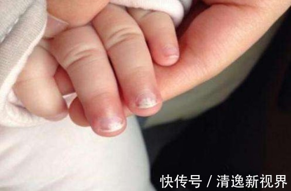 儿科医生|儿科医生如果孩子缺锌,一般身上都会有6个明显的“提示”