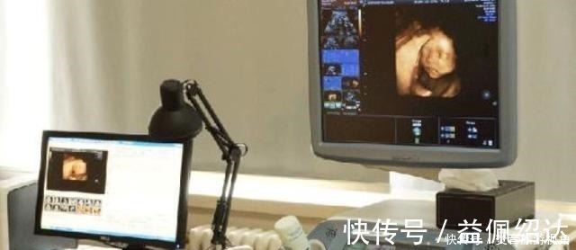 检查|“天才”胎儿走红,还在妈妈肚里就会“算数”,医生清华北大等你