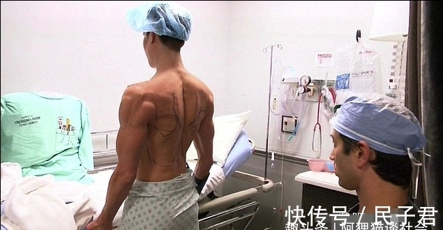 翅膀 男子花200万植入翅膀，接受120次整容手术，现与“芭比娃娃”相爱