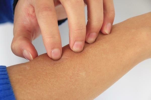 这种病|男童患白癜风,“祸首”竟是一条裤子?到底咋回事?家长要注意