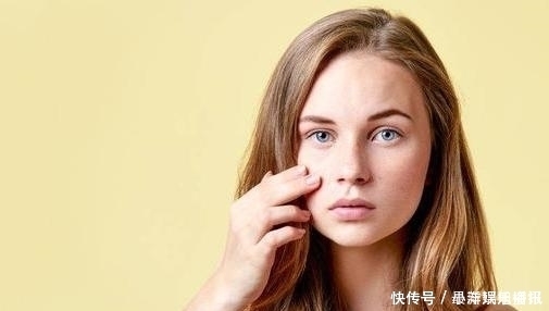 肌肤|怎么去脸上的红血丝,去红血丝的方法有哪些