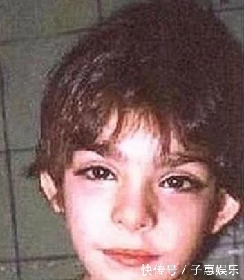 发育不良|宝宝长得太漂亮也是一种病?“歌舞伎综合征”到底是个什么鬼