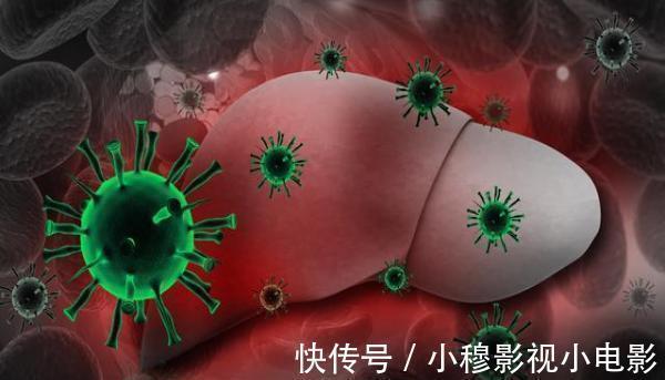 面色|肝癌总是晚期才发现其实早有4个预兆,很多人都错过了