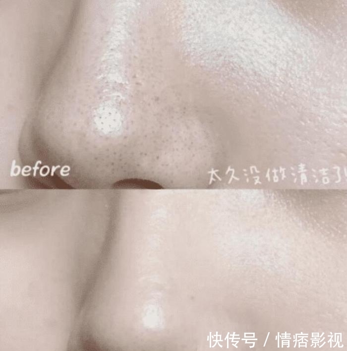 分钟|李佳琦5分钟卖空20000支的洗面奶有多好用?网友:7次闭口消除了