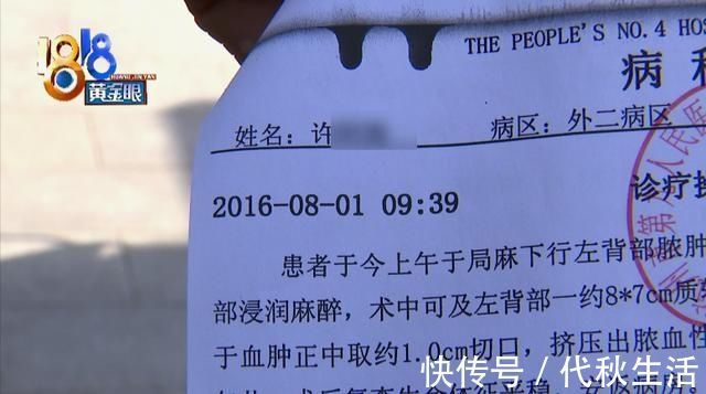 社区卫生院|四年前手术留下的引流管,最近才被取出来?