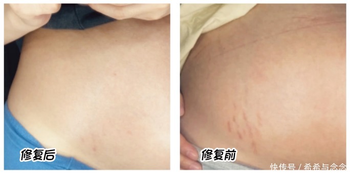 孕晚期|惠若琪快生了!怀孕期间还一直工作,像极了孕晚期职场孕妈的样子