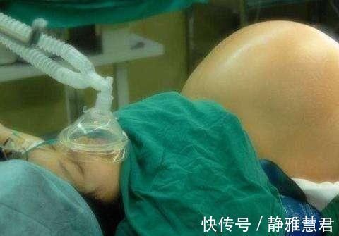 速度|分娩时什么原因决定分娩的速度?真的是屁股大好生养吗?