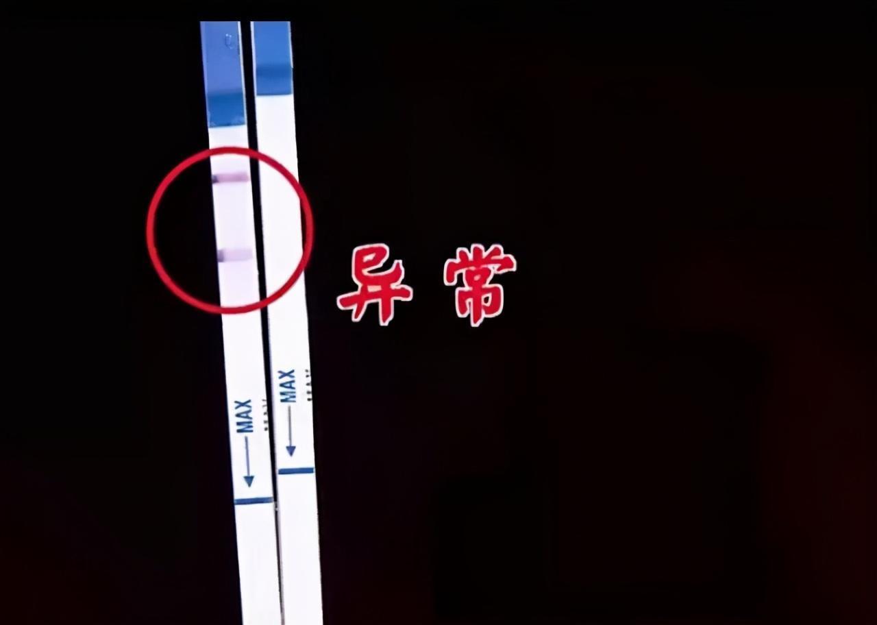 空腹血糖|「糖尿病」找准时机,3个办法帮助逆转糖尿病发生发展