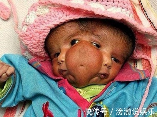 叶酸|怀孕20周,四维彩超却发现胎儿畸形,闻到孕妇身上的味道明白了