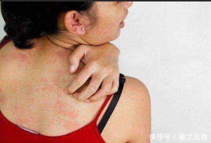 异位性皮炎|床铺螨虫多,家里孩子常过敏,教你一个土办法,螨虫连根拔起