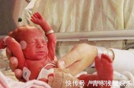 受精卵|孕妇8次流产第9次终于成功怀孕,孩子出生后,护士竟吓得不敢抱