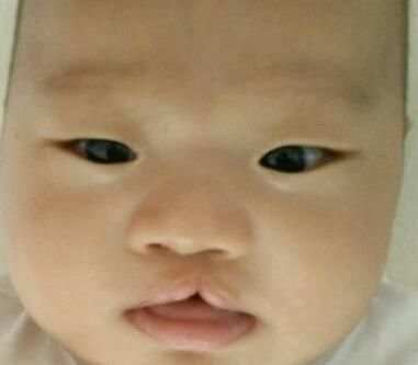 怀孕|产妇生出“兔唇儿”,谎称孕期吃了兔肉,被揭穿后婆婆很生气