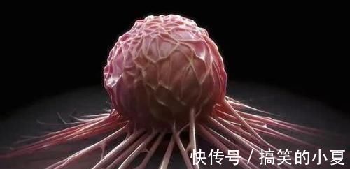 免疫体|不易“惹癌”的人,一般有5个共同点,全占的人是“癌症免疫体”