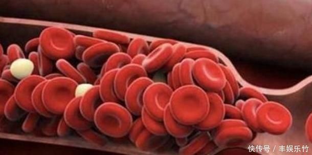 肠胃|50岁后,若能熬过3道“坎”,长寿或会偏爱你,分享给有缘人!