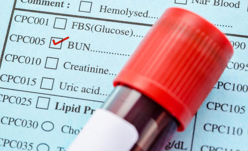 化验单|关于肾功能，体检化验单上的这些参考值，你读懂了吗？