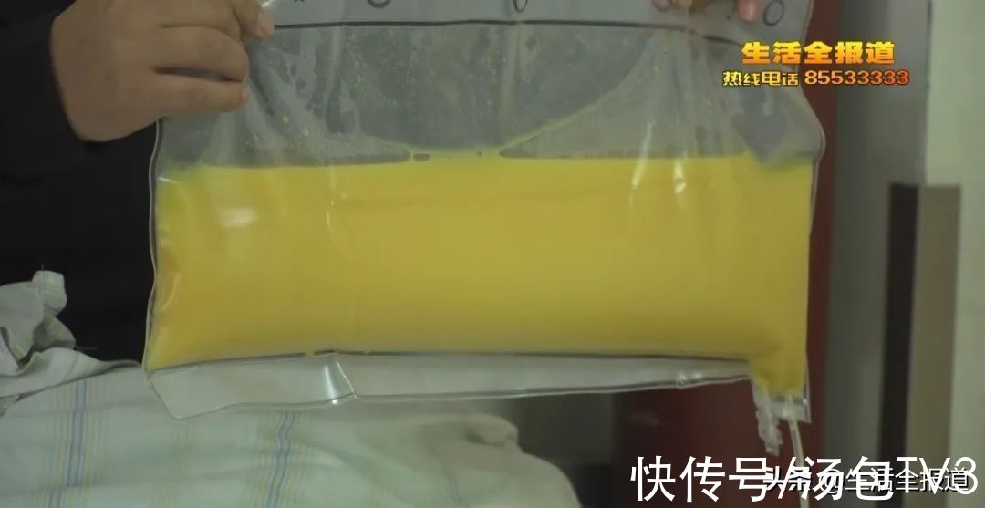 恶习|可怕！男子体检竟从血中抽出2升“油浆”这些恶习要不得