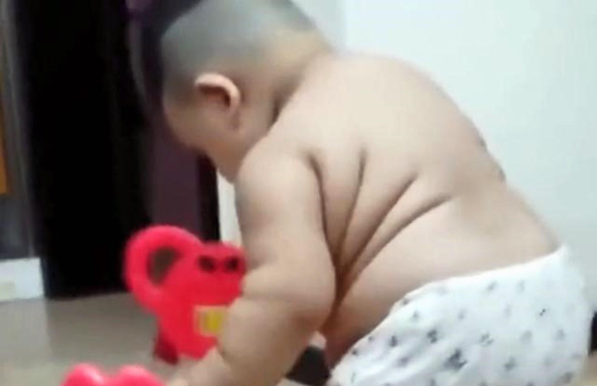 宝宝|1岁宝宝体重30斤,被母乳“催熟”到浑身肉坨,医生别沾沾自喜