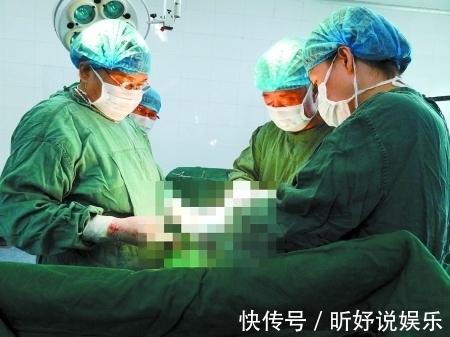 怀孕|怀孕八个月去产检,医生表示必须尽快手术,剖开肚子医生连退三步