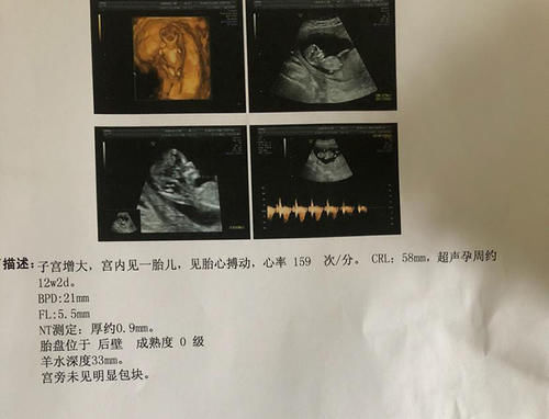 孕酮|确定怀孕后，第一次产检是在什么时候？超过这个时间，就晚了