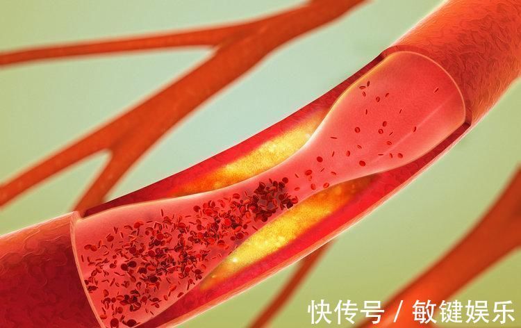 血管|睡觉时出现5种表现,说明血管“堵塞”了,若你没有就偷着乐吧