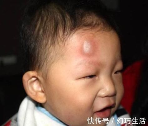 妈妈|1岁宝宝摔下床,妈妈的做法让奶奶直呼太冷血!医生却说:做得对