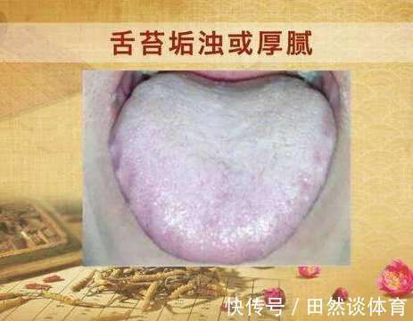 方子|一个非常强大的方子，只需3味药，把痰湿彻底根除，神清气爽