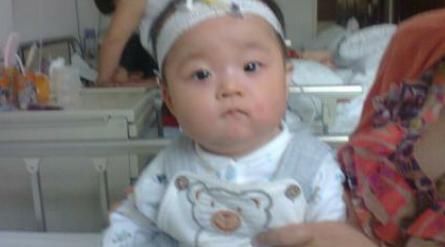 指压法|微量元素——已被叫停6年的儿科检查,很多家长却还深信不疑