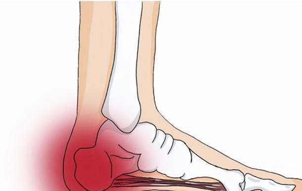 三镜|中医常说观3镜,知全身!屁为脾之镜,胁为肝之镜,踵为肾之镜