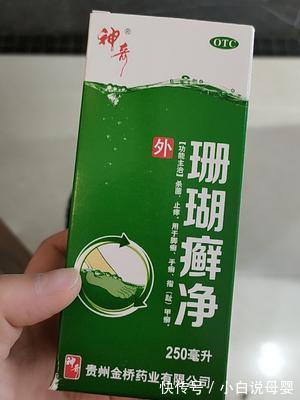 体股癣|脚气常见可分两种 中医帮你来治疗