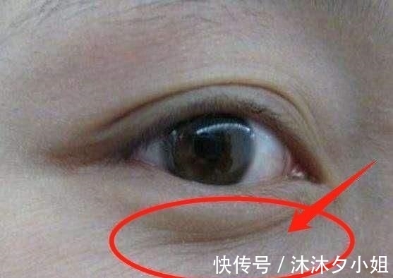 黑眼圈|子宫好的女人, 脸上可能有这4个现象? 你若占1个, 子宫还很健康