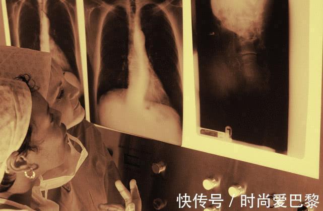 橘红|肺不好的人，把1种水果晒干泡水喝，清除肺部垃圾，养肺更润肺