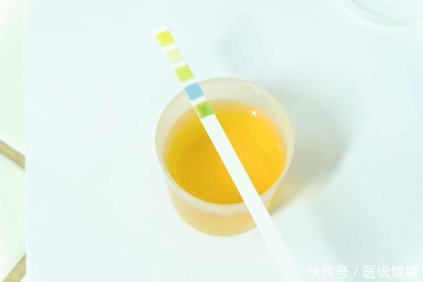 出血|肝脏出问题时,身体或有4种症状表现,若你有,该养肝了