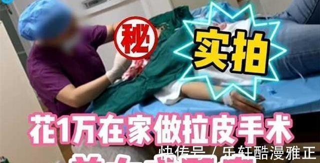 非法行医罪 女子花一万在朋友家做拉皮手术,最终成面瘫,朋友无证被逮捕