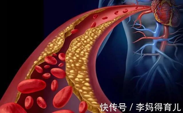 血液粘稠|内科医生:血脂升高,脸部会给你“暗示”,及时检查,不要拖延
