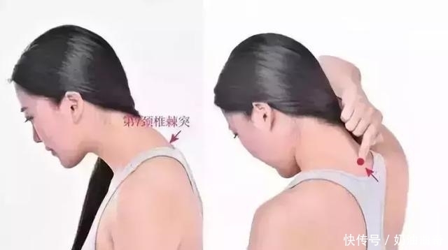 可怕|颈椎病头晕不可怕,1分钟肩颈操,一学就会,坚持2周,颈椎病好