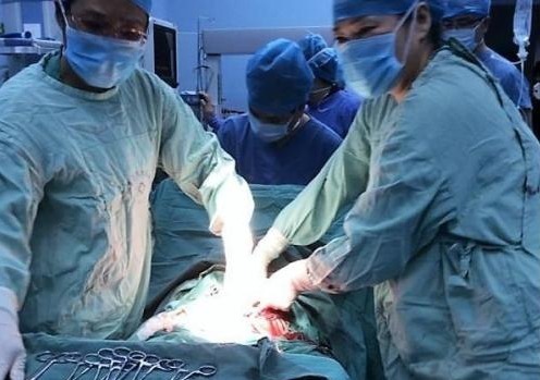 五胞胎|27岁孕妇怀上多胞胎,准备减胎时,发现一个意外惊喜